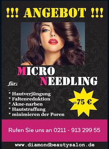 Micro Needling Düsseldorf